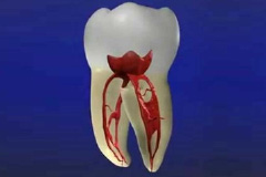再発率の低い根管治療には歯科医院選びが重要
