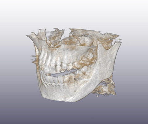 歯科用CTで撮影した場合